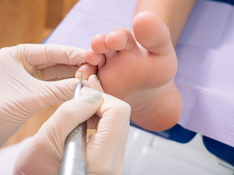 Dallas Foot Doctors Who Treat Heel Pain and Injuries